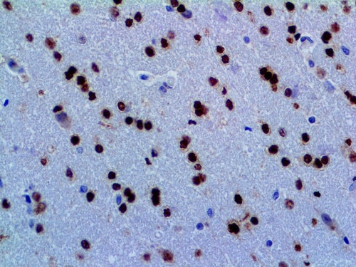 IHC of OLIG2 on an FFPE Brain Tissue